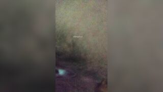 穿玫色衣服的舞蹈生抄底拉屎，菊花上粘着黄色的排泄物，逼逼周围